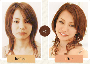 before after